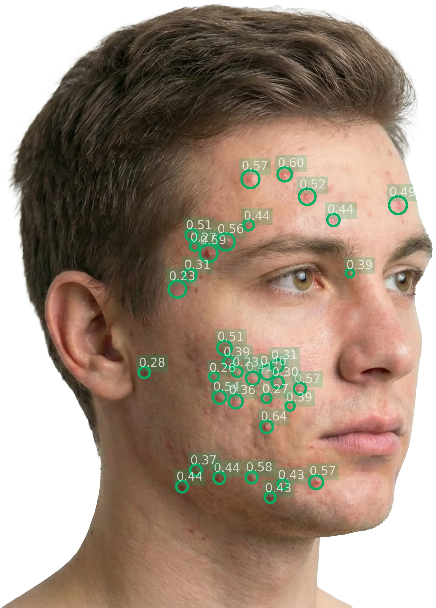 Analyzed Left diagonal